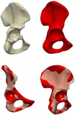sw-rnoh-ucl-ssm-pelvis.jpg