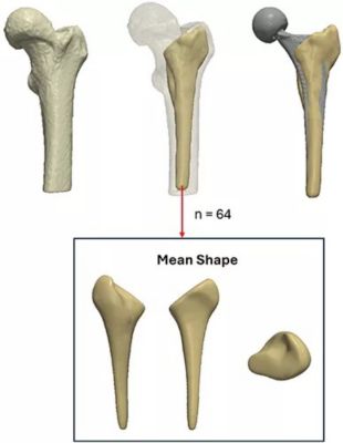 sw-rnoh-ucl-ssm-stem.jpg