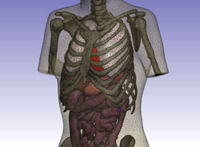 Meshed human body model generated from CT images in Simpleware.